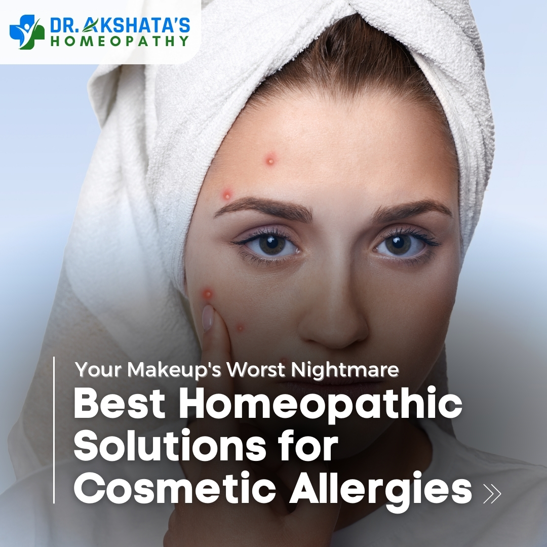 Best Homeopathic Medicines For Skin Allergy From Cosmetics