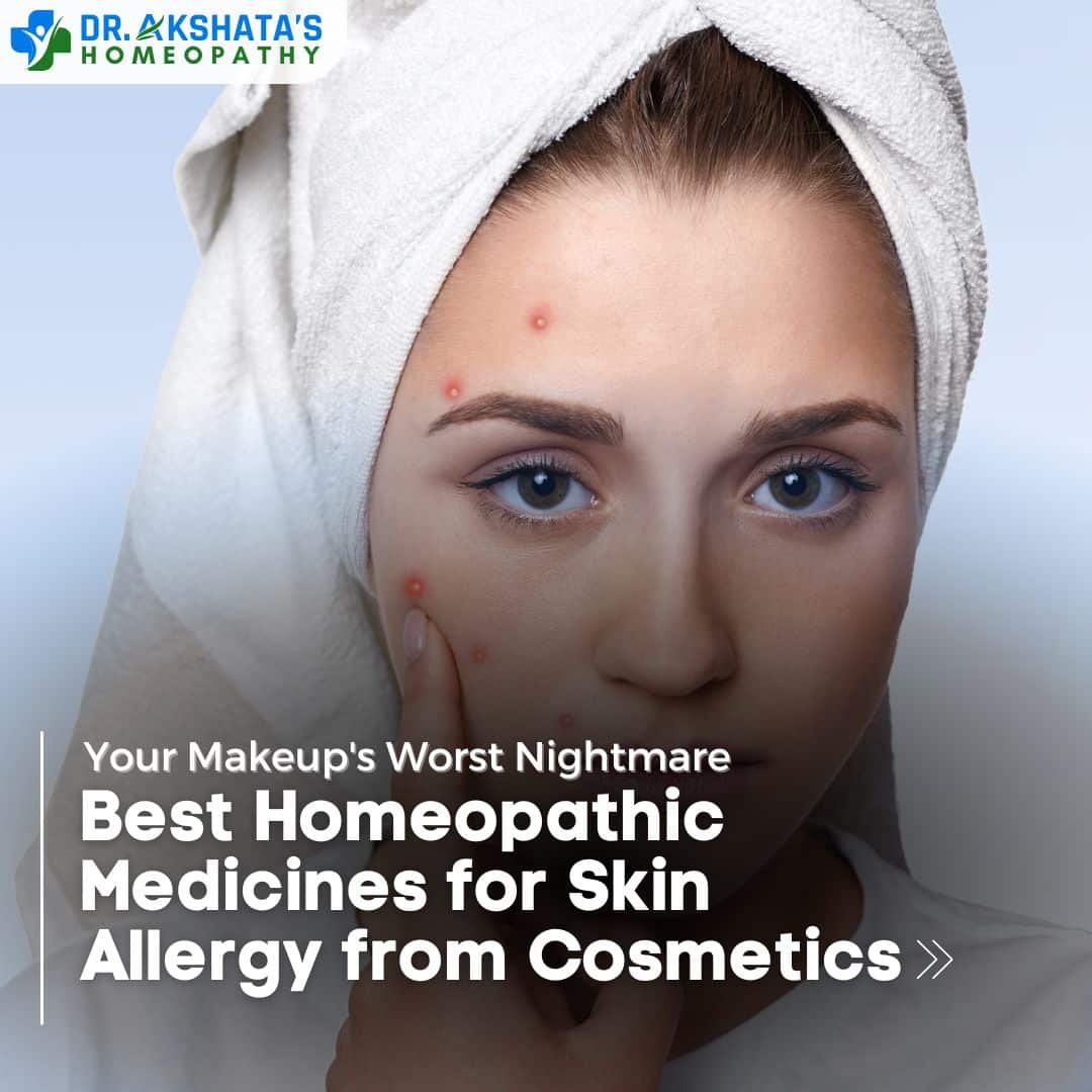 Best Homeopathic Medicines for Skin Allergy from Cosmetics