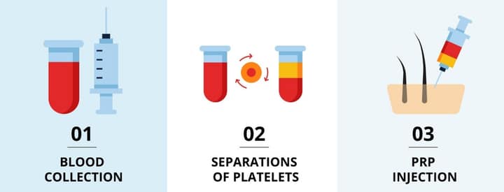 Hair PRP Treatment in Pune, Hair PRP Doctor in Pune